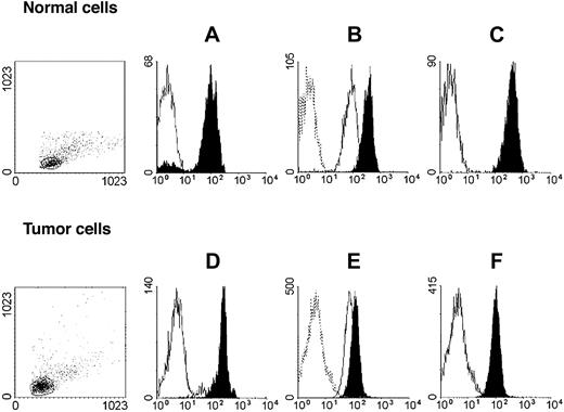 Figure 2. HLA class I antigen expression by immunomaganetic isolated lymphoid leukemic and autologous normal lymphocytes. Untouched autologous normal cells (top row) were stained with anti-CD3 (black) and anti-CD19 (white) mAbs (A); anti–HLA-A mAb LGIII-147.4.2 (open, solid line), anti–HLA-B mAb B1.23.2 (black), and control mAb (open, dotted line) (B); and with anti–HLA-A, -B, -C mAb W6/32 (black) and control mAb (white) (C). Untouched leukemic cells from a patient with CLL-B (bottom row) were stained with anti-CD3 (white) and anti-CD19 (black) mAbs (D); anti–HLA-A mAb LGIII-147.4.2 (open, solid line), anti–HLA-B mAb B1.23.2 (black), and control mAb (open, dotted line) (E); and with anti–HLA-A, -B, -C mAb W6/32 (black) and control mAb (white) (F). Forward/side scatter dot plots of the isolated cell populations are shown on the left.