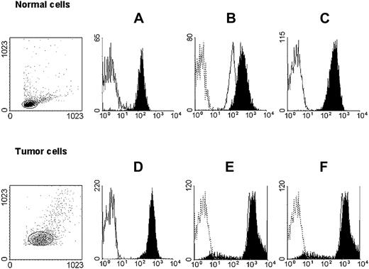 Figure 3. HLA class I antigen expression by immunomagnetic isolated myeloid leukemic and autologous normal myeloid cells. Untouched autologous normal cells (top row) were stained with anti-CD3 (black) and anti-CD33 (white) mAbs (A); anti–HLA-A mAb LGIII-147.4.2 (open, solid line), anti–HLA-B mAb B1.23.2 (black), and control mAb (open, dotted line) (B); and with anti–HLA-A, -B, -C mAb W6/32 (black) and control mAb (white) (C). Untouched leukemic cells from a patient with AML (bottom row) were stained with anti-CD3 (white) and anti-CD33 (black) mAbs (D); anti–HLA-A mAb LGIII-147.4.2 (open, solid line), anti–HLA-B mAb B1.23.2 (black), and control mAb (open, dotted line) (E); and with anti–HLA-A, -B, -C mAb W6/32 (black) and control mAb (white) (F). Forward/side scatter dot plots of the isolated cell populations are shown on the left.