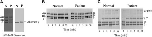 Figure 1. SDS-PAGE analysis of purified fibrinogen. Fibrinogen was purified from citrated plasma obtained from the patient (P) and healthy subjects (N) and was studied for the apparent molecular mass, the release of fibrinopeptides A and B by thrombin, and cross-linking of γ and α chains. (A) SDS-PAGE analyses (SDS-PAGE) of purified fibrinogen and identification of the γ chain by Western blotting using the γ chain–specific monoclonal antibody (Western blot). (B) Conversion of Aα and Bβ chains to α and β chains by thrombin treatment in the absence of calcium. (C) Formation of γ dimer (γ-γ) and α polymer (α-poly) upon thrombin treatment in the presence of FXIII and 2 mM calcium was analyzed by SDS-PAGE.
