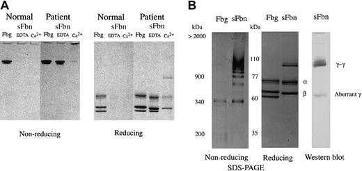 Figure 3. SDS-PAGE analysis of soluble Tokyo V fibrin. Tokyo V fibrinogen was incubated with thrombin (1 U/mL) and FXIII (1 U/mL) in the presence of 2 mM calcium (Ca2+) or 2 mM EDTA (EDTA) at 37°C for 1 hour. Formed clots were squeezed using bamboo sticks to separate soluble fibrin (sFbn) from fibrin clots. (A) Untreated fibrinogen, insoluble clots, and soluble fractions were analyzed by SDS-PAGE using 7.5% polyacrylamide gels under nonreducing and reducing conditions. (B) For analysis of cross-linked soluble Tokyo V fibrin, the supernatant of the patient fibrin preparation was separated on 3% polyacrylamide gels under nonreducing conditions. Fibrinogen (Fbg) was the control. The reduced supernatant sample was analyzed by Western blotting for identification of γ chain. γ-dimers (γ-γ) and the aberrant γ chain (aberrant γ) were indicated.