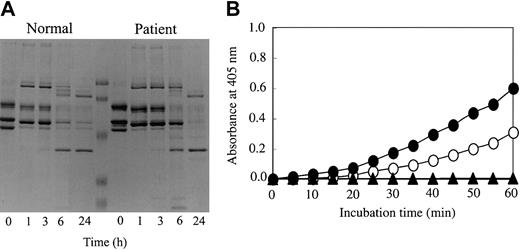 Figure 6. Analysis of tPA-catalyzed plasmin digestion of fibrin and tPA-mediated plasmin generation on fibrin surfaces. (A) Normal or patient fibrinogen was incubated with plasminogen, tPA, FXIII, and thrombin in the presence of calcium. After the indicated time periods, samples were heated at 98°C in the presence of 2% SDS and 10 mM DTT for 5 minutes to terminate the reaction and then analyzed by SDS-PAGE. (B) Normal fibrinogen (•) or patient fibrinogen (○) was incubated with plasminogen, tPA, FXIII, thrombin, and S-2251 in the presence of 2 mM calcium. As a control, normal fibrinogen (▴) was incubated in buffer containing plasminogen, tPA, and S-2251 or in buffer containing plasminogen, tPA, and thrombin. The changes in absorbance at 405 nm were monitored. Background absorbance determined with samples incubated in the absence of S-2251 at 405 nm were subtracted from all values.