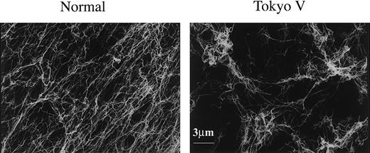 Figure 8. Scanning electron microscopy of fibrin clots. Scanning electron microscopy images of normal fibrin clots (left) and Tokyo V fibrin clots (right) are shown (bar equals 3 μm).