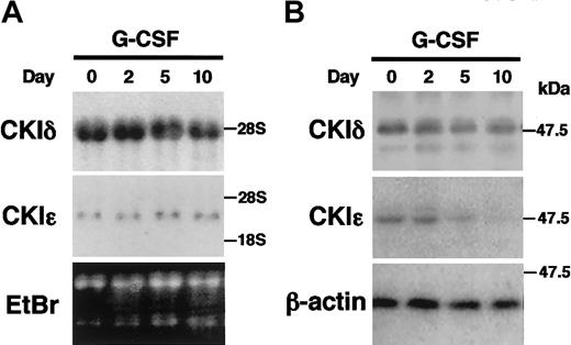 Figure 2. Decreased expression of CKIϵ in G-CSF–induced granulocytic differentiation of 32D cells. 32D cells were treated with 10 ng/mL G-CSF in a differentiation medium. Total RNAs and cell lysates extracted at days 0, 2, 5, and 10 were subjected to RNA blot analysis by using CKIδ- and CKIϵ-specific cDNA probes (A), or immunoblot analysis using anti-CKIδ, CKIϵ, and β-actin (control) polyclonal antibodies (B). Ethidium bromide (EtBr) staining indicates the amount of RNAs loaded in each lane.
