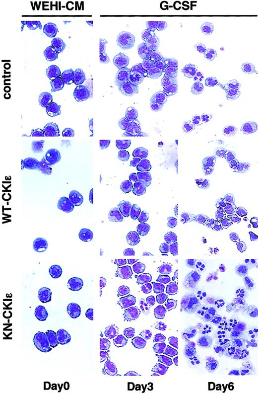Figure 4. Effect of exogenous CKIϵ on morphological differentiation. Photomicrographs of 3 types of cell lines Wright-stained and cultured in a medium containing 15% WEHI-CM (day 0) and then in a differentiation medium with 10 ng/mL G-CSF for 3 and 6 days are shown (original magnification, × 400).