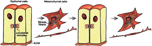 Figure 2. EMT entails loss of cell junctions, detachment from fixed ECM adherence, and further induction of motility, whereas MET is the reverse phenomenon. These processes may occur sequentially during embryogenesis.