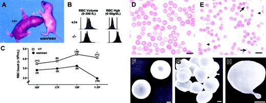 Figure 1. Hematologic status of C3H/HeJwan homozygotes. (A) A C3H/HeJwan/wan newborn with a wild-type (+/+) littermate. Note the extreme pallor of the wan homozygote. (B) RBC volume and hemoglobin concentration histograms of whole blood from normal (+/+) and wan/wan (-/-) newborn mice. Significant populations of small (left panels) and dehydrated (right panels) RBCs are present in mutant blood compared with controls. (C) RBC counts are decreased in wan/wan fetuses compared with normal littermates. The differences are significant (*P < .001) by fetal day 18 and at birth. (D-E) Wright-stained peripheral blood smear from a newborn C3H+/+ mouse (D) and a mutant C3Hwan/wan mouse (E). Many RBC fragments (arrowheads) and membrane projections (arrows) are evident in mutant blood smears. Bar = 10 μM. (F-H) Scanning electron photomicrographs of normal (F) and mutant (G-H) RBCs. Mutant RBCs are predominantly spherocytic (G) with frequent membrane projections (H). Bar = 1 μM.