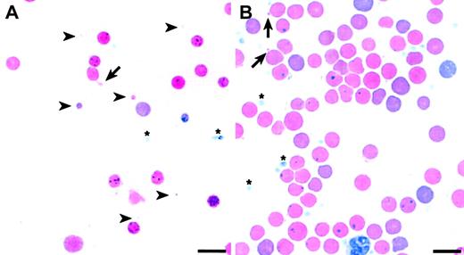 Figure 6. Pleiotropic RBC morphologies in F2 wan homozygotes. (A) Wright-stained peripheral blood smear showing extreme microspherocytosis and tubular membrane extensions (arrow). Note that some microcytes (arrowheads) are smaller than platelets (asterisks). (B) Peripheral blood smear showing significantly improved overall RBC morphology. Evidence of some membrane loss, however, persists (arrows). Bar = 10 μM.