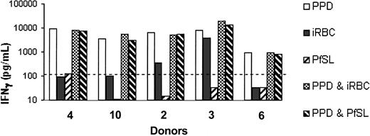 Figure 5. The interaction between uninfected erythrocytes and parasite antigens does not suppress IFN-γ responses to PPD. IFN-γ (pg/mL) was assayed in 6-day supernatants of PBMCs cultured with uninfected red blood cells (equivalent to 1:10 dilution of whole blood) plus 5 μg/mL PPD; 5 × 105/mL iRBCs; 5 × 105/mL lysed schizonts (PfSL); PPD plus iRBCs; or PPD plus PfSL. Data from 5 donors are shown. The dotted line indicates the LLD for the IFN-γ ELISA (125 pg/mL).