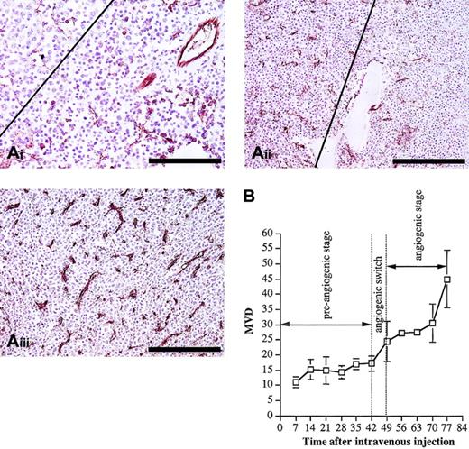Figure 3. Histologic analysis and evolution of the MVD. (A) Histologic analysis and CD31 staining of BM samples during 5T2MM disease progression. From the onset of the tumor inoculation 3 mice were analyzed each week until the end stage of the disease was reached. From each mouse one hind leg was processed for CD31 staining. (i) Preangiogenic stage: Small tumor aggregates were formed (upper left corner) without increase of the MVD. The right part of the figure illustrates tumor-free normal BM tissue. This section was made from a mouse killed at day 35. Bar = 100 μm. (ii) Early angiogenic stage: The angiogenic stage started when large confluent aggregates of MM cells were formed (left). On the right side, in the noninvaded part of the BM, the MVD is lower than on the left side. This section was made from a mouse killed at day 49. Bar = 200 μm. (iii) Late angiogenic stage: Massive BM invasion was accompanied by a high MVD. Most of the microvessels are small and intensely stained for CD31. This section was made from a mouse at day 77. Bar = 200 μm. Each section is representative for 3 mice. (B) Evolution of the MVD during 5T2MM disease progression. MVD (number of blood vessels per 0.20 mm2) was quantified as described in “Materials and methods.” Each point represents mean values of 3 mice ± SD.