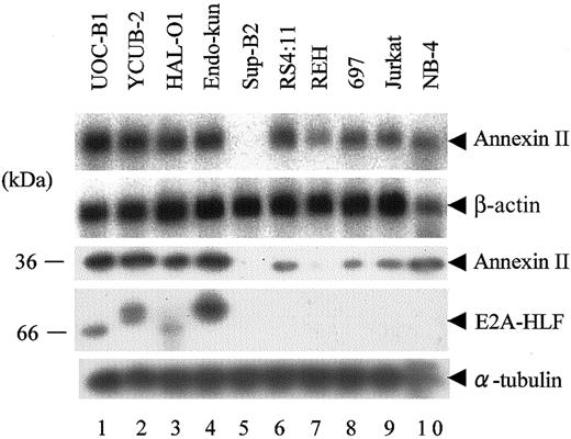 Figure 1. Expression of annexin II in human leukemia cell lines. (Top 2 panels) Northern blot analysis of poly(A)+ RNA (1 μg per lane) isolated from human leukemia cell lines. The blot was hybridized with an annexin II cDNA probe and then rehybridized with a β-actin probe. (Lower 3 panels) Immunoblot analysis using whole-cell lysates. Annexin II, E2A-HLF, and α-tubulin proteins were detected with specific antibodies. Lanes 1 to 4: UOC-B1, YCUB-2, HAL-O1, and Endo-kun t(17;19)–positive pro-B ALL cell lines. Lanes 5 to 8: Sup-B2, RS4;11, REH, and 697 pro-B ALL cell lines without t(17;19). Lane 9: Jurkat T-ALL cell line. Lane 10: NB-4 APL cell line.