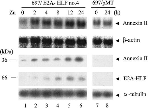Figure 2. Induction of annexin II by enforced expression of E2A-HLF in human ALL cells. 697 cells inducibly expressing E2A-HLF (697/E2A-HLF cells) and control 697/pMT cells were cultured in medium containing 100 μM Zn2+ for the indicated times. (Top 2 panels) Northern blot analysis of poly(A)+ RNA (1 μg). The blot was hybridized with an annexin II cDNA probe and then rehybridized with a β-actin probe. (Lower 3 panels) Immunoblot analysis detecting annexin II, E2A-HLF, and α-tubulin proteins.