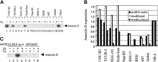Figure 5. Immunodetection of annexin II from the cell surface of human leukemic cell lines. (A) Human leukemia cell lines were treated with either HBSS alone (lanes with a minus sign) or HBSS containing 4 mM CaCl2 (lanes with a plus sign) for 30 minutes. Annexin II proteins were detected with specific antibodies. (B) The levels of mRNA and total and surface annexin II were determined by the band intensity of autoradiograms from Figures 1 and 5A. Amounts shown are relative to levels in the NB-4 APL cell line. AnnII/b-actin indicates ratio of annexin II mRNA to β-actin mRNA; annII(total), total annexin II protein; and annII(surface), surface annexin II protein. (C) 697/E2A-HLF cells and 697/pMT cells were cultured in medium with or without 100 μM Zn2+ as indicated for 16 hours before treatment with either HBSS alone (lanes with a Ca2+ minus sign) or HBSS/Ca (lanes with a Ca2+ plus sign). Annexin II proteins were detected using specific antibodies.