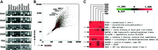 Figure 1. Expression profiling of 6 huES cell lines. (A) RT-PCR analysis of 6 ES cell lines showed consistent expression of markers of undifferentiated cells. PES cells are a pooled sample of 3 huES cell lines (GE01, GE07, and GE09). G3PDH served as an internal control. (B) Scatter plot analysis of cy5- and cy3-labeled genes in BG02 huES cells and huURNA sample indicating differential gene expression. Some significantly overexpressed ES cell genes are listed. (C) Hierarchical clustering of genes that were expressed 3-fold or at a higher level compared with huURNA. The color indicates the relative expression levels of each gene, with red indicating higher expression, green indicating negative expression, and black representing absent expression. The 5 genes as indicated by the arrows were not present in all cell lines. The minimum spot intensity for all genes was set at 150 fluorescence units except for the CER1 and DNMT3B genes; the minimum intensity was set at 100 fluorescence units for this analysis only to compare expression with other genes within the same array.