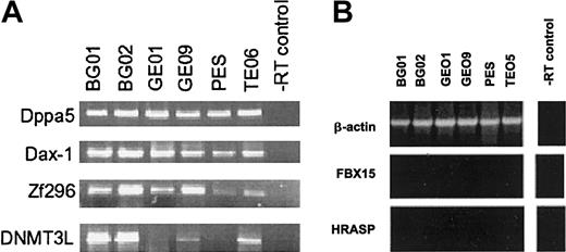 Figure 3. RT-PCR analysis of genes reported to be specific to mouse ES cells. (A) RT-PCR analysis of Dppa5, Dax-1, Zf296, and DNMT3L genes. (B) RT-PCR analysis of FBX15 and HRASP (ERAS) genes. FBX15 and HRASP were not detected in any cell line, whereas DNMT3L was present though levels were variable.