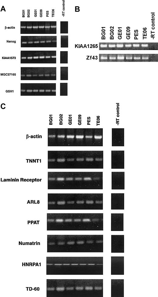 Figure 4. RT-PCR confirmation of various novel genes enriched in all 6 huES cell lines. (A) Expression of Nanog (FLJ12581) and 3 novel genes (KIAA1573, MGC27165, and GSH1), (B) KIAA1265 and Zf43 genes, and (C) TNNT1, Laminin receptor, ARL8, PPAT, Numatrin, HNRPA1, and TD-60. β-actin served as an internal control and RT without input DNA as a negative control.