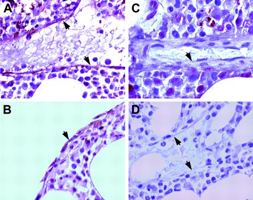 Figure 7. HA is detected in the endosteum and the marrow sinusoidal but not arteriolar endothelium. Staining of normal human BM sections was performed using the biotinylated HA binding protein (bHABP) and avidin-biotin horseradish peroxidase counterstained with Mayer hematoxylin. Arrows indicate the sinusoidal endothelium (A), the endosteal cells (B), and the arteriolar endothelium (C). Preincubation with hyaluronidase prevented HA labeling of sinusoidal endothelium by bHABP (D). Original magnification, × 1500 (A,C-D); and × 1000 (B).