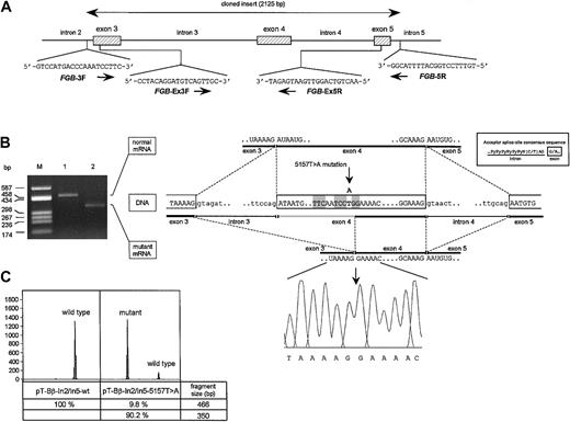 Figure 2. Analysis of the effect of the 5157T>A mutation on fibrinogen Bβ chain pre-mRNA splicing. (A) Schematic representation of a region of FGB spanning from intron 2 to intron 5. Position and nucleotide sequence of primers used in cloning experiments (FGB-3F and FGB-5R) and in RT-PCR assays (FGB-Ex3F and FGB-Ex5R) are reported. Exons and introns are drawn to scale. (B; left) RT-PCR products obtained with the primer couple FGB-Ex3F and FGB-Ex5R separated on a 2% agarose gel. Lane M indicates molecular weight marker (pUC8-HaeIII); lanes 1-2, RT-PCR products amplified from transfected HeLa cells expressing wild-type or mutant mRNAs, respectively. (Right) Schematic representation of the normal (top) and aberrant (bottom) splicing events. Nucleotide sequences at the exon/intron boundaries are reported. The position of the 5157T>A mutation in exon 4 of FGB is indicated by an arrow. Nucleotides surrounding the mutation and matching the acceptor splice site consensus sequence (boxed on the right) are shaded in gray. The region of exon 4 skipped from the aberrant transcript is colored in light gray. The sequence electropherogram confirming the aberrant junction between exon 3 and exon 4 in the RT-PCR product from HeLa cells transfected with the mutant construct is also shown. (C) Semiquantitative analysis of the RT-PCR products as in panel B by means of the fluorescent hot-stop PCR technique. Labeled products were separated on an automated DNA sequencer and analyzed by the GeneScan software. Peak intensities are reported as GeneScan fluorescence units (y-axis). The left and the right panels correspond to RT-PCR products amplified from HeLa cells transfected with wild-type or mutant plasmids, respectively. Fragment size and relative amounts of fluorochrome-labeled RT-PCR products are listed in the table underneath. The percentage values correspond to the peak areas, setting the sum of peak areas of each experiment equal to 100%.