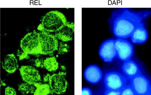 Figure 1. Cytoplasmic REL staining in the RC-K8 human DLBCL cell line. RC-K8 cells10 were analyzed by indirect immunofluorescence using an anti-REL antiserum against the C-terminal 15 amino acids of REL, as described by Houldsworth et al.4 In the right panel, nuclear DNA was detected in the same field using DAPI (4′,6 diamidino-2-phenylindole). Original magnification, × 600.