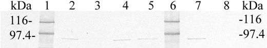 Figure 1. Western blot. After transfer to the membrane the blot was probed with anti-IVAPLA2 (Santa Cruz Biotechnology) at a 1:300 dilution and peroxidase-conjugated rabbit antimouse at the same dilution. Color development used diaminobenzidine tetra hydrochloride (DAB). Lane 1 shows molecular weight markers; lane 2, U937 cell lysate prior to Prosep column application (3 μg); lane 3, eluate from the Prosep column after U937 application (10 μg); lane 4, SDS elution from U937 Prosep column (7 μg); lane 5, SDS elution from red cell Prosep column (12 μg); lane 6, molecular weight markers; lane 7, platelet preparation (10 μg); lane 8, leukocyte preparation (39 μg). The numbers given in parentheses for each lane refers to the total protein applied to the gel.