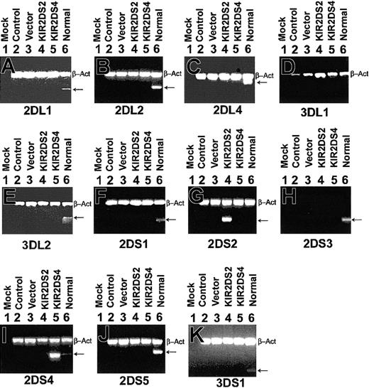 Figure 3. Specific amplification of KIRs in K562. RNA was amplified using primers specific for KIR2DL1, KIR2DL2, KIR2DL4, KIR3DL1, KIR3DL2, KIR2DS1, KIR2DS2, KIR2DS3, KIR2DS4, KIR2DS5, and KIR3DS1 from K562 cells that were untransfected (Control, lane 2), pcDNA3 vector control transfected (Vector, lane 3), pcDNA3-KIR2DS2 transfected (KIR2DS2, lane 4), and pcDNA3-KIR2DS4 transfected (KIR2DS4, lane 5). Normal 1 was used as a positive control for all KIR primers (lane 6) but was found to be negative for KIR3DL1 (D). β-Actin primers were included to ensure that a similar amount of cDNA was present in each sample (top band, β-Act). Reaction with water was included as a negative control for each set of primers (Mock, lane 1).
