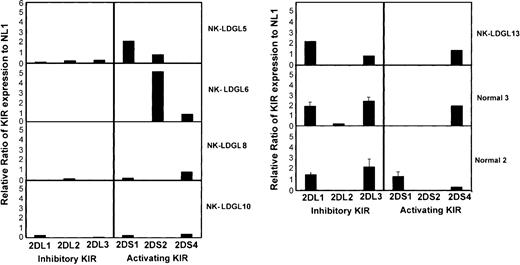 Figure 4. Semiquantitative RT-PCR analysis in patients with NK-LDGL. RT-PCR was performed using primers to amplify the inhibitory receptors KIR2DL1 (2DL1), KIR2DL2 (2DL2), KIR2DL3 (2DL3) and the activating receptors KIR2DS1 (2DS1), KIR2DS2 (2DS2), and KIR2DS4 (2DS4), and β-actin using the conditions described in “Patients, materials, and methods.” Reactions were performed using RNA from 3 healthy individuals and 5 patients with NK-LDGL. The graph represents densitometry results of samples normalized to β-actin and then expressed as a ratio to data obtained from normal 1 that is positive for each reaction. Raw data for normal 1 is shown in Figure 3. Normal 1, normal 2, and normal 3 were run on the same gel with each patient sample and the standard deviation is shown for these samples.