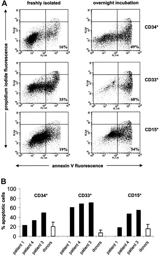Figure 3. Accelerated spontaneous apoptosis of hematopoietic progenitor cells in Kostmann syndrome. (A) The degree of spontaneous apoptosis upon overnight incubation of CD34+ early progenitors, CD33+ myeloid progenitors, and CD15+ neutrophil precursor cells obtained from patient 3. The percentage of apoptotic cells, defined as annexin V+, propidium iodide-events, is indicated in the lower right quadrant of each subpanel. (B) Spontaneous apoptosis of CD34+, CD33+, and CD15+ progenitor cell subpopulations from Kostmann patients and healthy controls (mean ± SD; n = 8), as evidenced by annexin V labeling. G-CSF therapy was discontinued for 7 days in patient 3, and for 36 hours in patients 1 and 4, prior to assessment of apoptosis.