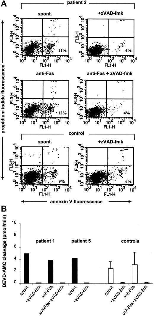 Figure 4. Caspase-dependent apoptosis of Kostmann bone marrow progenitor cells. (A) CD34+ cells from patient 2 were incubated overnight in the presence or absence of the caspase inhibitor zVAD-fmk (10 μM) and subsequently labeled with annexin V to allow for the detection of apoptosis. Cells incubated in the presence of anti-Fas antibodies (250 ng/mL) were also tested. For comparison, data obtained in a healthy control are also shown. (B) Caspase-3-like enzyme activity in bone marrow progenitor cells from Kostmann patients. CD34+ cells isolated from patients 1 and 5 were incubated overnight in the presence or absence of zVAD-fmk (10 μM), and lysates were then assessed for DEVD-AMC cleavage in a continuous fluorometric assay. The maximum linear rate of AMC release (picomoles per minute) was estimated by linear regression (r2 > 0.99). Cells from patient 1 were also evaluated after treatment with anti-Fas antibodies (250 ng/mL). Data obtained in cells from healthy controls are shown for comparison (mean ± SD; n = 3). All patient samples were obtained 12 hours after the last dose of G-CSF.