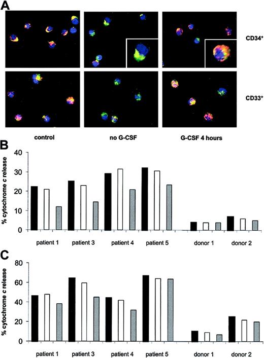 Figure 5. Constitutive mitochondrial release of cytochrome c in Kostmann progenitor cells. (A) Mitochondria of CD34+ and CD33+ cells were stained with MitoTracker Red, and cytochrome c localization was revealed by indirect immunofluorescence. Representative images of cells from patient 3 and from a healthy control are displayed. The punctate yellow pattern denotes mitochondrial localization of cytochrome c, and the diffuse green pattern indicates cytochrome c that has been released into the cytosol (see insets for typical examples). Original magnification × 40. (B) Release of cytochrome c from mitochondria of CD34+ progenitors of Kostmann patients and healthy controls, as determined by confocal microscopy. Black bars indicate freshly isolated cells; white bars, 4 hours in vitro incubation (no G-CSF); and gray bars, 4 hours in vitro incubation (with G-CSF; 100 ng/mL). All Kostmann patients were maintained off therapy for 60 hours prior to bone marrow aspiration. (C) Release of cytochrome c from mitochondria of CD33+ progenitors of Kostmann patients and controls, determined as in panel B.