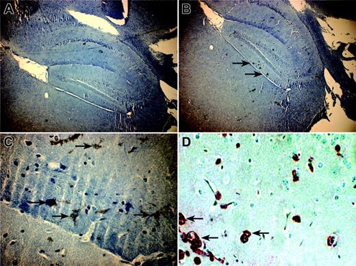 Figure 3. Distribution of human eGFP MSC-derived cells in brain of NOD/SCID mice. Pictures were taken in confocal microscopy from 5 μm-thin sagittal sections of brain of NOD/SCID mice. (A) A × 40 magnification of a cross section incubated with a nonrelevant antibody (negative control). (B) Cross sections, magnified × 40 and (C) × 400, of brain incubated with anti-GFP antibody counterstained with hematoxylin. (D) A × 400 magnification of brain cross section incubated with anti-β2-microglobulin antibody counterstained with hematoxylin. Black arrows indicate positive GFP cells (B-C) and human β2-microglobulin-positive cells (D) in the dentate gyrus area.