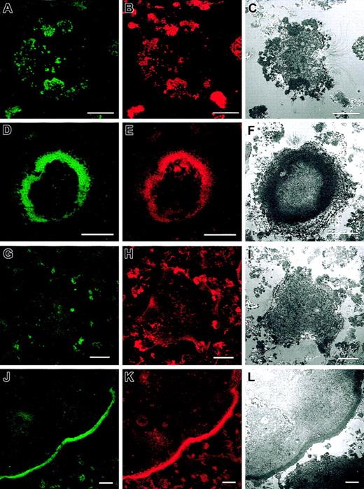 Figure 5. Organization of actin filaments in normal and WASp-/- osteoclasts at adhesion points on the substratum. Confocal fluorescent and IRM images were taken to detect vinculin (A, D, G, J) and F-actin distribution (B, E, H, K), showing that the adhesion points of the cells with the substratum detected by IRM (C, F, I, L) corresponded to the actin structures we detected by immunofluorescence. Adhesion points in normal osteoclasts were mediated by podosomes in noncircular clusters (A-C) or inserted in actin rings (D-F). In WASp-null osteoclasts, attachment of cells to the substratum was mediated by actin patches (G-I) or dysmorphic actin rings (J-L). Bar, 20 μm.