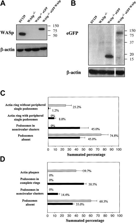 Figure 6. Expression of eGFP WASp in WASp-null cells results in the reconstitution of the normal organization of the actin cytoskeleton. Bone marrow-derived osteoclasts from normal (SV129), WASp-null (WASp-/-), or WASp-null transduced with eGFP (WASp-/-eGFP) or eGFP-WASp (WASp -/-eGFP-WASp) were lysed in RIPA buffer at day 7 after plating and subjected to a 10% SDS-PAGE gel electrophoresis, probed with anti-WASp (A) or anti-eGFP antibodies (B). Signal was detected with horseradish peroxidase-conjugated secondary antibodies and enhanced chemiluminescence (ECL) detection system. Visualization of eGFP required a 10-second film exposure, whereas visualization of eGFP-WASp required 90 seconds of exposure. Blots were stripped with 2% SDS and 0.7% β-mercaptoethanol for 1 hour at 50°C and reprobed for β-actin to check the total amount of protein loaded per lane. WASp-null bone marrow osteoclasts derived on glass coverslips (C) or bone slices (D) and transduced with eGFP (▦) or eGFP WASp (▪) were fixed with 3% paraformaldehyde, permeabilized with 0.05% Triton X-100, and the presence of actin filaments and vinculin was detected by immunofluorescence. We quantified the percentage of cells displaying each of the identified arrangements of actin filaments in 100 cells per experiment. The graphs illustrate the mean percentage of cells ± SD from 3 experiments.
