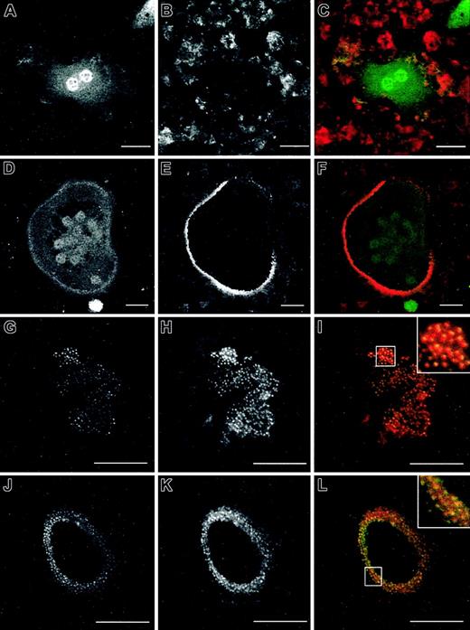 Figure 7. Reconstitution of podosomes in WASp-null osteoclasts plated on glass coverslips by expression of eGFP WASp. WASp-null cells were transduced with eGFP (A-F) or eGFP-WASp (G-L). Distribution of eGFP is shown in panels A and D, and distribution of eGFP-WASp in panels G and J. Actin organization was detected by immunostaining with Alexa 568-conjugated phalloidin (B, E, H, K). Merged images are shown in panels C, F, I, and L. Cells transduced with eGFP were devoid of podosomes (A-C) or assembled abnormal actin rings with few podosome-like structures inserted (D-F). eGFP did not colocalize specifically with any cytoskeletal structure (C, F). Transduction of eGFP WASp resulted in reconstitution of podosomes and formation of clusters similar to normal cells in both migrating cells (G-I) and cells with actin rings (J-L). eGFP WASp colocalized specifically with the actin core of podosomes (insert in I, L). The micrographs are representative of the cytoskeletal organization of osteoclasts detected in 3 independent experiments. Bar, 20 μm.