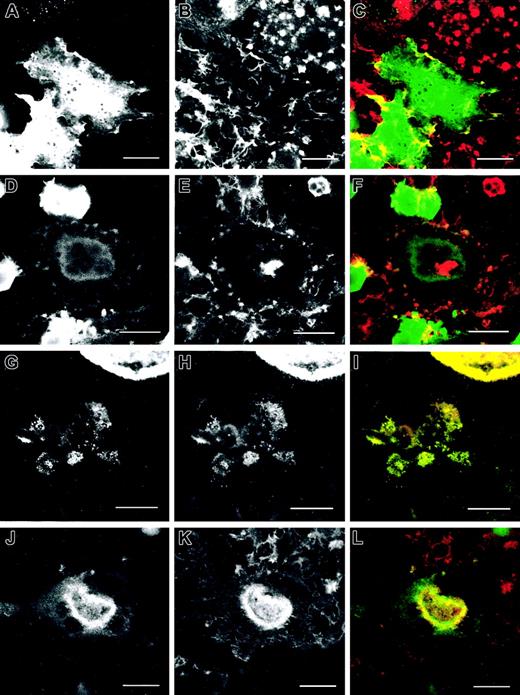 Figure 8. Reconstitution of podosomes in WASp-/- osteoclasts plated on bone slices by expression of eGFP WASp. WASp-null cells were transduced with eGFP (A-F) or eGFP-WASp (G-L). Actin organization was detected by immunostaining with Alexa 568-conjugated phalloidin (B, E, H, K). Similarly to nontransduced WASp-null cells, cells transduced with eGFP were devoid of podosomes (A-C) or assembled actin-rich plaques (D-F). eGFP did not colocalize specifically with any cytoskeletal structure (C, F). Expression of eGFP WASp resulted in the formation of actin-based structures similar to wild-type normal cells with podosomes in migratory cells (G-I) and actin rings (J-L). eGFP-WASp colocalized with podosomes (G-I) and actin rings (J-L). The micrographs are representative of the cytoskeletal organization of osteoclasts detected in 3 independent experiments. Bar, 20 μm.