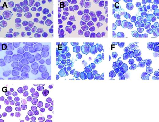 Figure 7. Morphologic differentiation of transfectants in response to G-CSF. Cytokine-treated cells were photographed 48 hours after addition of IL-3 or G-CSF and after May-Grünwald-Giemsa staining. Original magnification × 200. (A) BaF3 cells transfected with vector alone retain the immature morphologic appearance of untransfected BaF3 cells. (B) Ba/F3 cells transfected with G-CSFR have a similar immature morphology when grown in IL-3. (C) When grown in G-CSF, Ba/F3GR cells acquire morphologic features of myeloid differentiation. (D) Ba/F3 cells transfected with the GRprox mutant, however, show little evidence of differentiation in response to G-CSF. (E) The appearance of myeloid differentiation is accentuated when Gab2 is overexpressed in cells expressing full-length G-CSFR. (F) Overexpression of Gab2 in GRprox cells partially restores the morphologic effects of the wild-type receptor. (G) Cells expressing a mutated Y764F receptor did not show differentiation.