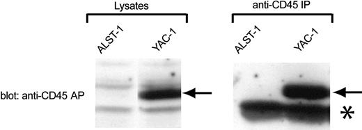 Figure 2. Absence of CD45-AP expression in ALST-1 cells. Cell lysates or anti-CD45 immunoprecipitates of ALST-1 and YAC-1 cells were immunoblotted with anti-CD45-AP antibody. The CD45-AP band is indicated by arrows. The prominent band, indicated by an asterisk, that is seen in immunoprecipitates of both cell lines represents immunoglobulin light chains.