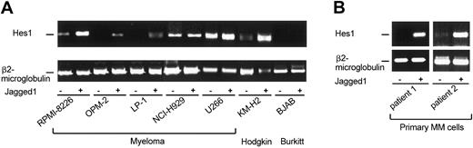 Figure 3. Jagged1-induced Notch target gene activation in MM cells. (A) Cocultivation of HtTA-jag10 cells expressing the Notch-ligand Jagged1 under tetracycline control11 (induction of Jagged1 expression by tetracycline withdrawal) and MM, Hodgkin, and Burkitt lymphoma cell lines expressing various amounts of endogenous Notch1 and Notch2 receptors. RT-PCR analysis showed increased levels of endogenous Hes-1 transcripts in cultured MM cells (RPMI-8226, OPM-2, LP-1) and in the Hodgkin lymphoma cell line KM-H2 after activation by Jagged1. KM-H2 cells served as a positive control. (B) Strong induction of Notch signaling by Jagged1 in primary MM cells.