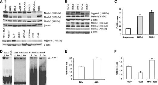 Figure 1. Activation of Notch pathway in myeloma cells following ligation to Jagged-1. (A) Expression of Notch family proteins and their ligand Jagged-1 was analyzed in 8 different human myeloma cell lines by Western blotting. (B) Expression of Notch family proteins and their ligands was evaluated by Western blotting in BMS cells obtained from 5 different BM donors. (C) Interaction between BMS and H929 cells resulted in activation of the Notch pathway in myeloma cells. H929 cells transfected with reporter or control constructs were incubated on BMS for 48 hours or kept in suspension (control). Luciferase activity (LA) was measured according to the manufacturer's protocol and normalized to 1 μg total protein. Data are presented as fold increase of the specific LA (H929 cells transfected with p6 × CBF-1-pKA9 plasmid) over control LA activity (cells transfected with pKA9 plasmid). Experiments were performed in triplicate and repeated twice with similar results. (D) Jagged-1 ligation activates Notch pathway in myeloma cells. H929, U266, RPMI-8226, or MM1S human myeloma cells and Burkitt lymphoma HS-Sultan cells were starved for one hour in serum-free RPMI-1640 medium and then incubated on the monolayer of irradiated 3T3-Jagged (J) or control 3T3-MSCV (Con) cells for 8 hours. Cells were then collected and nuclear extract was prepared. EMSA with CBF-1-specific probe was performed. “Cold inh” indicates cold inhibition control. (E-F) Notch activation in myeloma cells results in an increase of HES-1 mRNA espression. The pcDNA3.1-Notch-1IC or pcDNA3.1 plasmids were introduced in U266 cells by electroporation and cultured for 24 hours and 48 hours (E). H929, RPMI-8226, or U266 myeloma cells were cultured on 3T3-Jagged or 3T3-MSCV cells for 48 hours (F). Real-time PCR was performed as described in “Materials and methods.” The mRNA expression for each sample was normalized to 18S mRNA expression. Data shown are fold increase of HES-1 expression in myeloma cells cultured on 3T3-Jagged over cells cultured on 3T3-MSCV (F) or U266 cells transfected with Notch-1IC-carrying plasmid over control plasmid (E). Differences were statistically significant for all cell lines studied. Error bars (C, E, F) indicate standard deviation.
