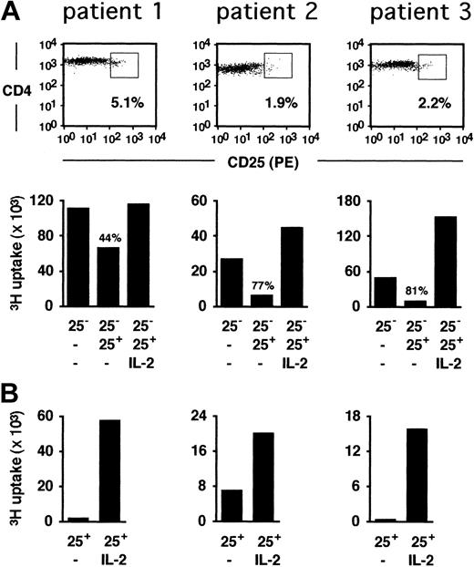 Figure 2. Functional characterization of CD4+CD25+ T cells in patients with symptomatic MC. (A) The blood CD4+CD25+ population was immunomagnetically sorted (25+) in 3 untreated patients with symptomatic MC, and assayed for its capacity to suppress anti-CD3 anti-CD28-mediated autologous responder cell (25-) proliferation at a 1:1 ratio, in the presence or absence of exogenous IL-2. Histograms represent the median of triplicates. Percent inhibition of proliferation is indicated. (B) Proliferative response of CD4+CD25+ T cells on anti-CD3 anti-CD28 activation, in the presence or absence of exogenous IL-2.