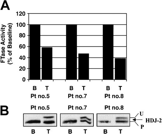 Figure 2. Tipifarnib treatment results in inhibition of FTase and HDJ-2 protein farnesylation in PBMN cells from patients with multiple myeloma. PBMN cells were processed for (A) FTase activity assay or (B) SDS-PAGE Western immunoblotting with anti-HDJ-2 antibody as described in “Materials and methods.” B and T designate baseline pretreatment levels and levels during the 3rd week of tipifarnib treatment, respectively. U and P designate unprocessed and processed HDJ-2, respectively. Control baseline cpm values ranged from 2437 to 3218 for FTase activity levels.