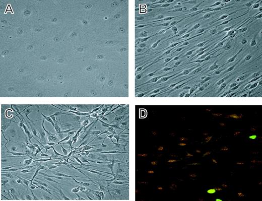 Figure 1. Derivation of uninfected and KSHV-infected DMVECs. (A) Phase image of uninfected DMVECs showing the classical cobblestone appearance of normal endothelial cells. (B) Phase image of age- and passage-matched KSHV-infected DMVECs showing spindle cell morphology following viral infection. (C) Phase image of KSHV-infected DMVECs demonstrating loss of contact inhibition. Image shows approximately 3 layers of cells in a 3-dimensional focus. (D) Corresponding immunofluorescence microscopic image showing staining for the latent viral protein ORF 73/LANA (red) and the lytic viral protein ORF 59/progressivity factor-8 (green). Cells were used for experimentation at 3 weeks after infection when more than 90% of cells stained positively for ORF 73. Spontaneous lytic reactivation of KSHV, as assessed by ORF 59 expression, was generally restricted to less than 2% of cells. Original magnification, × 20.
