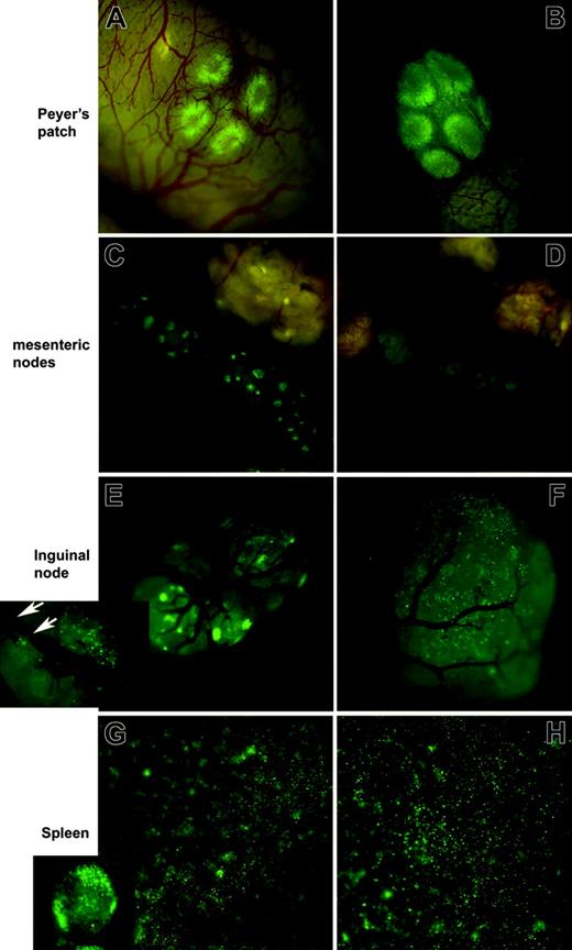 Figure 1. Irradiation is not required for early localization of allogeneic donor splenocytes to peripheral lymph nodes. Splenocytes from eGFP Tg C57BL/6 mice were injected intravenously into B10.BR mice that were lethally irradiated (8 Gy; A, C, E, G) or were not irradiated (B, D, F, H) the day before cell infusion. Images captured 6 hours after infusion are shown for the indicated tissues. Tissues from 1 of 3 representative mice per group are shown. Examples of single-cell resolution are indicated by the white arrows (E, inset). Stereomicroscope was set to 10.0 × zoom factor with a 0.63 × transfer lens.