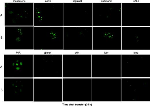 Figure 2. Localization of donor splenocytes to the lymph nodes at 24 hours after infusion is similar in allogeneic and syngeneic recipients. Splenocytes from eGFP Tg C57BL/6 mice were injected intravenously into lethally irradiated B10.BR mice (A, allogeneic) or C57BL/6 (S, syngeneic) mice. Tissues from 1 of 3 representative mice from each time point per group are shown. Stereomicroscope was set to 10.0 × zoom factor with a 0.63 × transfer lens.