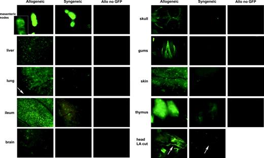 Figure 4. eGFP+ cells are present in the lymphoid organs at day 7 after BMT in syngeneic mice, but these cells are either not present or are present only at low frequencies in GVHD target organs compared with allogeneic recipients. Images of close-up views of several organs captured at day 7 after infusion of C57BL/6 BM and eGFP Tg splenocytes in allogeneic and syngeneic recipients as indicated. A cohort of mice receiving an equivalent number of non-eGFP allogeneic splenocytes was also imaged as a control for potential autofluorescence caused by GVHD-induced tissue injury. All images were captured with 1.09-second exposure times to allow direct comparison. The inset shown in the mesenteric node was taken with a 16-msec exposure time because of the intensity of the fluorescence in the nodes. Stereomicroscope was set to 10.0 × zoom factor with a 0.63 × transfer lens. LA indicates long axis cut of head with stereomicroscope set to 3.0 × zoom factor with a 0.63 transfer lens.