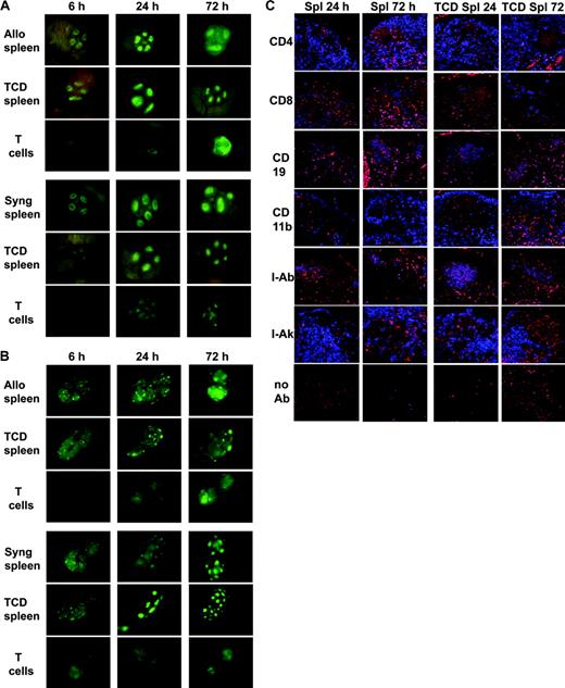 Figure 5. Migration and expansion of donor T cells in the lymph nodes occurs independently of non-T donor splenocytes and vice versa. (A) Peyer patch. (B) Inguinal node. B10.BR mice (for allogeneic studies) or C57BL/6 mice (for syngeneic studies) were lethally irradiated and given C57BL/6 BM with either whole splenocytes, TCD splenocytes, or purified T cells from eGFP Tg C57BL/6 mice. TCD splenocytes homed to the B-cell and myeloid areas (cortical lymphoid nodules), whereas the T cells homed to the T-cell zone (deep paracortex). In the allogeneic setting, donor T cells expanded 48 to 72 hours after infusion. Tissues from 1 of 3 representative mice from each time point per group are shown. Stereomicroscope was set to 10.0 × zoom factor with a 0.63 × transfer lens. (C) Confocal microscopy of lymph node cryosections costained with anti-eGFP antibody (red) and the indicated phenotypic marker (blue). Costained cells are depicted as violet-purple. On the left are nodes taken 24 and 72 hours after BMT of allogeneic BM and eGFP Tg whole splenocytes. On the right are nodes taken 24 and 72 hours after BMT of allogeneic BM and eGFP Tg TCD splenocytes. The images are consistent with the data in Figure 5A and 5B showing that donor cells localized early, at 24 hours after transplantation to the lymphoid follicles, consisted predominantly of B cells (CD19) and fewer myeloid cells (CD11b). eGFP Tg T cells (CD4 and CD8) are predominantly in the paracortex and were more apparent at 72 hours after transplantation. Original magnification × 200.