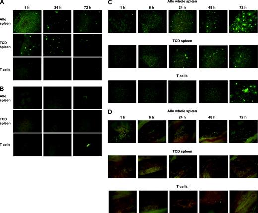 Figure 6. Migration and expansion of donor T cells occurred independently of non-T donor splenocytes and vice versa. (A) Lung, (B) liver, (C) spleen, and (D) femur. B10.BR mice were lethally irradiated and given C57BL/6 BM with either whole splenocytes or TCD splenocytes or purified T cells from eGFP Tg C57BL/6 mice. Tissues from 1 of 3 representative mice from each time point per group are shown. Stereomicroscope was set to 8.0 × (lung, liver, spleen) and 10.0 × (femur) zoom factor with a 0.63 × transfer lens.