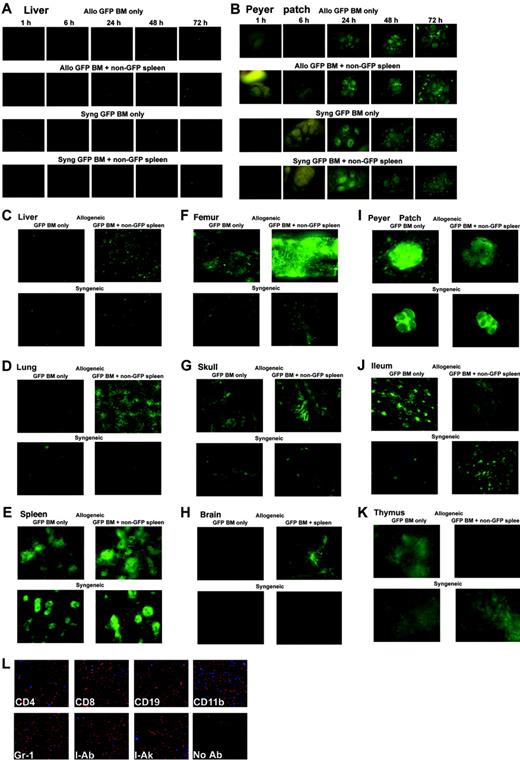 Figure 7. Coinfusion of allogeneic splenocytes facilitates engraftment of BM and homing of allogeneic BM to GVHD target organs. B10.BR mice (for allogeneic studies) or C57BL/6 mice (for syngeneic studies) were lethally irradiated and given BM from eGFP Tg C57BL/6 mice with or without whole splenocytes from non-eGFP C57BL/6 mice. Early time points (1-72 hours after BMT) for the liver (A) and Peyer patches (B) are shown. Day 7 time points are shown for liver (C, L), lung (D), spleen (E), femur (F), skull (G), brain (H), Peyer patch (I), ileum (J), and thymus (K). Tissues from 1 of 3 representative mice from each time point per group are shown. Stereomicroscope was set to 10.0 × zoom factor with a 0.5 × transfer lens. (L) Confocal analysis of immunofluorescence costaining in the liver of a mouse given allogeneic eGFP Tg BM and non-eGFP splenocytes for phenotypic identification of donor eGFP Tg BM-derived cells on day 7 after BMT. Cryosections were costained with anti-eGFP antibody (red) and the indicated phenotypic marker (blue). Costained cells are depicted as violet-purple. Donor eGFP Tg BM-derived cells expressing CD8, CD19, CD11b, Gr-1, and donor MHC class 2(I-Ab) were seen. Original magnification × 200.