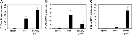 Figure 1. Increased transcription of inflammatory mRNA on day 20 in tc-ptp-/- animals. The mRNA levels for (A) TNF-α, (B) iNOS, and (C) IFN-γ in tc-ptp-/- mice (▪) and their wild-type littermates (□) at 20 days after birth. Bars represent the mean ± SE from 4 to 5 mice with tc-ptp-/- values shown as fold increase from those of age-matched tc-ptp+/+ mice. Statistical significance was determined by a 2-tailed unpaired Student t test. *P < .05; **P < .005; ***P < .001 tc-ptp-/- compared with tc-ptp+/+.