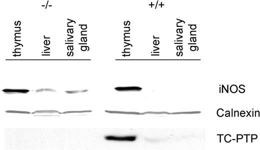 Figure 2. Up-regulation of iNOS protein in tc-ptp-/- mice. Western blots showing TC-PTP and iNOS expression in the thymus, liver, and salivary gland of 3-week-old mice. Calnexin was used as a loading control. Data shown are representative of 3 separate experiments.