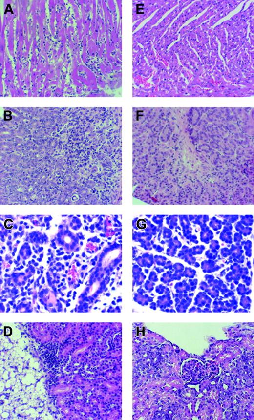 Figure 6. Systemic inflammation in tc-ptp-/- mice. (A) Light micrograph of myocardium of tc-ptp-/- mouse 21 days old (D21) featuring interstitial edema, prominent interstitial mononuclear cellular infiltrate, and patchy myocyte degeneration and necrosis. (B) Light micrograph of gastric mucosa of tc-ptp-/- mouse age D21 featuring dense mononuclear cellular infiltrate with patchy destruction of gastric epithelium. (C) Light micrograph of parotid gland of tc-ptp-/- mouse age D21 demonstrating mononuclear cellular infiltrate. (D) Light micrograph of kidney and adjacent adipose tissue of tc-ptp-/- mouse age D21 demonstrating mononuclear cellular infiltrate in the superficial renal cortex and adjacent perinephric adipose tissue. (E-H) Light micrographs of myocardium (E), gastric mucosa (F), parotid gland (G), and kidney (H) of tc-ptp+/- mice age D21 showing normal histology. All panels stained with H and E; original magnification × 200 for all panels.