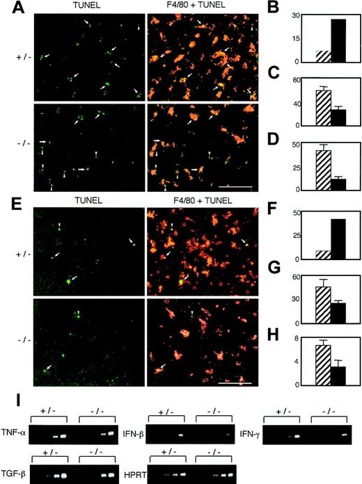 Figure 2. Defective apoptotic cell uptake by PSR-deficient macrophages without induction of inflammatory cytokines. (A,E) The E13.5 liver sections (A) and E16.5 thymus sections (E) of PSR+/- and PSR-/- littermates were stained with TUNEL (green) and anti-F4/80 antibody (red). Typical examples of phagocytosed or unphagocytosed apoptotic cells are shown by the arrows or arrowheads, respectively. The white bar indicates 100 μm. (B,F) The percentage of unphagocy tosed apoptotic cells in E13.5 liver sections (B) or E16.5 thymus sections (F) is compared between PSR+/- (▨, n = 640 for liver sections and n = 106 for thymus sections) and PSR-/- (▪, n = 176 for liver sections and n = 44 for thymus sections) littermates. (C,G) The number of F4/80+ macro phages per 100 000 μm2 of E13.5 liver sections (C) or E16.5 thymus sections (G) is compared between PSR+/- (▨) and PSR-/- (▪) littermates. F4/80+ cells with more than 60 μm2 of surface area were counted. (D,H) The total number of TUNEL-positive cells per 100 000 μm2 of E13.5 liver sections (D) or E16.5 thymus sections (H) is compared between PSR+/- (▨) and PSR-/- (▪) littermates. (I) The E18.5 thymuses of PSR+/- and PSR-/- littermates were analyzed for the expression of TNF-α, IFN-β, IFN-γ, and TGF-β by RT-PCR. The primers used to amplify IFN-β were described elsewhere.14 For amplification of TNF-α, IFN-γ, and TGF-β, sets of specific primers were obtained from Toyobo (Osaka, Japan). The gene encoding hypoxanthine phosphoribosyl transferase (HPRT) used as a control was amplified with the following primers: 5′-CACAGGACTAGAACACCTGC-3′ and 5′-GCTGGTGAAAAGGACCTCT-3′. Amplification increases by 3 cycles, from the left to the right, starting at 22 cycles for TGF-β and HPRT, or at 25 cycles for TNF-α, IFN-β,and IFN-γ. Error bars (B-D, F-H) indicate standard deviation.